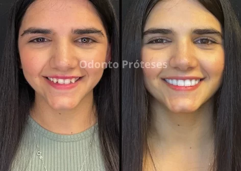 tratamento03